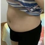 Healthy Detox Patches - Japanese Weight Loss Belly Button photo review