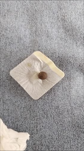 Healthy Detox Patches - Japanese Weight Loss Belly Button photo review