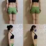 Healthy Detox Patches - Japanese Weight Loss Belly Button photo review
