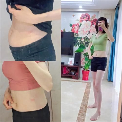 Healthy Detox Patches - Japanese Weight Loss Belly Button photo review