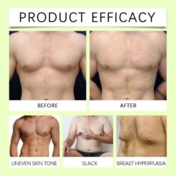 Men Chest Reduction Gynecomastia Patch