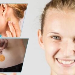 Motion Sickness Relief Patch