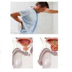 Prostatic Bladder Control Urinary Incontinence Patch